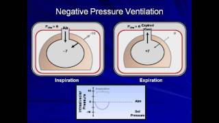 An Introduction to Mechanical Ventilation Mechanical Ventilation  Lecture 1 [upl. by Mharba]