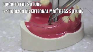 Back to the suture  5 Horizontal external mattress suture [upl. by Gilges690]