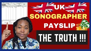 The whole truth about Sonographers salary in UKUltrasoundtechsalary NHSSonographer payslip [upl. by Eiaj274]