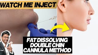 Fat Dissolving Injections For Double Chin Cannula HowTo [upl. by Alick]