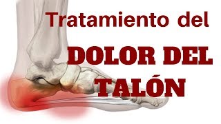 TRATAMIENTO DEL DOLOR DEL TALÓN [upl. by Darcee]