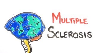 What Is Multiple Sclerosis [upl. by Batruk362]