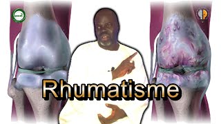 1  Rhumatisme Symptômes et Causes  Pr Ousmane Ndiaye  SAMA XALAAT TV [upl. by Ume432]