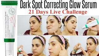 Axis y Dark Spot Correcting Glow Serum Review with ⛔live Results [upl. by Ijneb]