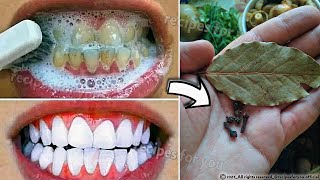 Secret that Dentists dont want you to know Remove Tartar and Teeth Whitening in just 2 minutes [upl. by Aneloj]