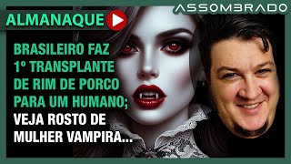 BRASILEIRO RECRIA ROSTO DE MULHER VAMPIRA E OUTRO FAZ 1º XENOTRANSPLANTE DE RIM e  AA 1101 [upl. by Nnaes]