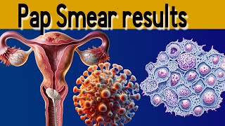 Pap Smear Results Explained under 3 minutes [upl. by Ainat]