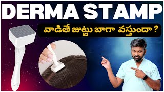 AskDrJohnWatts  DERMA STAMP వాడితే జుట్టు బాగా వస్తుందా   Hair Specialist Explains [upl. by Yanetruoc]