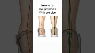 How to fix overpronation with exercise⚠️ exerciseroutine overpronation sports motivation [upl. by Aniretac875]