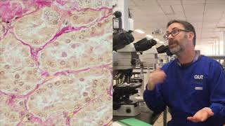 Microscope tutorial  Troubleshooting the Van Gieson stain [upl. by Ylehsa482]