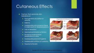 Chapter 25 Lecture Immobility and Associated Problems [upl. by Carbrey]