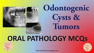 Oral Pathology MCQs  Cysts and Tumors of the Jaws and Oral Cavity [upl. by Doolittle]