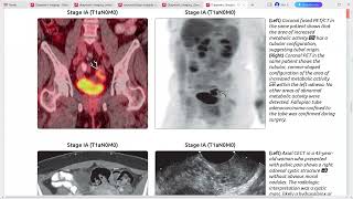 GYNAE IMAGING DIAGNOSTIC IMAGING SERIES [upl. by Rentschler]