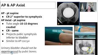 Urinary Imaging Radiology  3 Cystogram [upl. by Reni986]