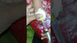 iv catheter with 24g cannula iv catheter inserting techniciv cannulacannulacannulation technic [upl. by Artus649]