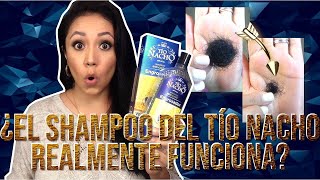 Shampoo del Tío Nacho ¿realmente funciona  Documentado [upl. by Danni]