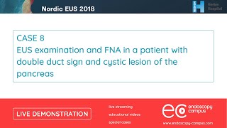 Livedemo  Nordic EUS 2018  EUS examination and FNA n a patient with double duct sign [upl. by Anayit]