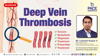 Deep Vein Thrombosis DVT  Causes Symptoms Risk Factors Diagnosis Prevention And Treatment [upl. by Lehcem]