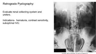 Radiology of the Urogenital system [upl. by Itnahsa]