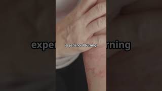 PanOxyl Acne Wash Effective or Irritating skincare acnetreatment [upl. by Nolte]