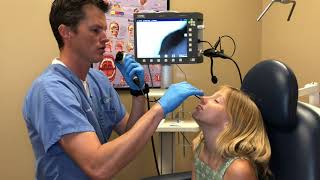 Pediatric Nasal Endoscopy Pediatric [upl. by Kiah318]