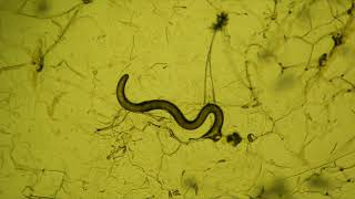 fungal predators of nematode worms [upl. by Ettennaj]