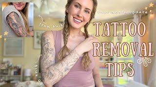 Tattoo Removal Tips  4 month update [upl. by Carmelita]