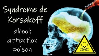 Les dangers de lalcool sur le cerveau syndrome de Wernicke Korsakoff un témoignage [upl. by Eirhtug]