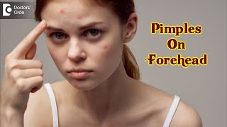 Pimples On Your Forehead Causes amp how to get rid of it  Dr Urmila Nischal  DoctorsCircle [upl. by Aniras687]