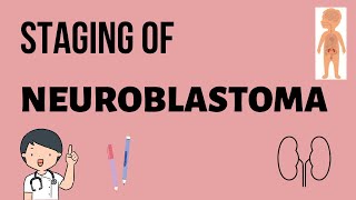 NEUROBLASTOMA STAGING [upl. by Melcher152]