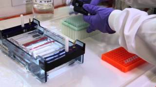 How to run an agarose gel [upl. by Naj]