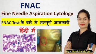 Fine Needle Aspiration Cytology  FNAC Test in hindi  FNAC test kya hota hai  FNAC test procedure [upl. by Em]