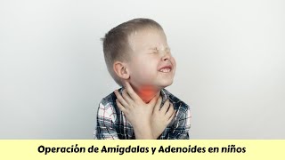 Operación de AMIGDALAS y adenoides en niños [upl. by Bolanger]