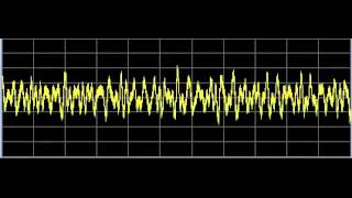 Lyme Disease  Rife Frequencies [upl. by Latta]