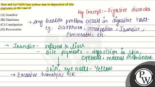 Skin and eye balls turn yellow due to deposition of bile pigments in the case of [upl. by Araeic]