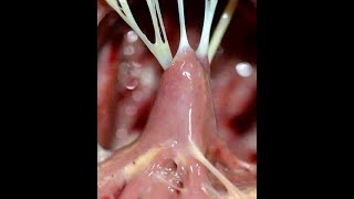 Chordae tendineae tendinous chords [upl. by Nealson]