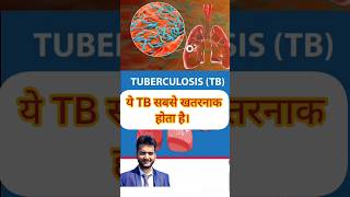 Tuberculosis TB MDR TB shorts medical [upl. by Enrichetta]