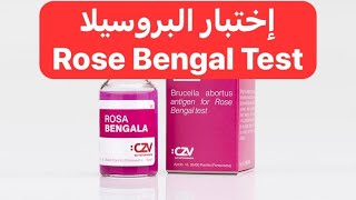 فكرة وقراءة إختبار Rose Bengal Test لتشخيص مرض البروسيلا [upl. by Ilatan134]