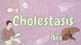 Cholestasis  liver pathology [upl. by Seabrooke]