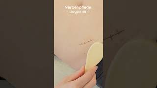 Narbenpflege beginnen [upl. by Nnad]