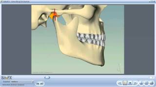 Anterior Guidance [upl. by Hardy]