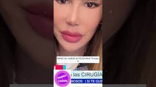 😭¿DEMASIADO CAMBIO¡IMPACTANTE REVELACIÓN Ninel Conde y Su NUEVO ROSTRO Tras 87 Cirugías 😱 [upl. by Niliac]