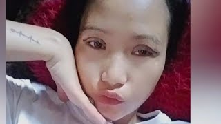 Selfcare  Double Eyelid Surgery Recovery [upl. by Theodore]