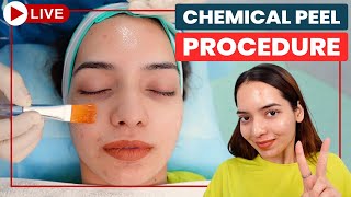 CHEMICAL PEELS Step by Step  Acne Scar Treatment in Delhi  Chemical Peeling Treatment Dr Jangid [upl. by Mueller]