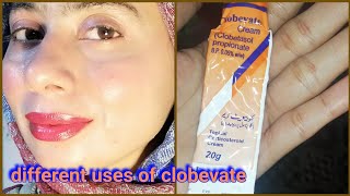 Clobevate cream for whitening  zartasha zar  clobevate cream [upl. by Malina]