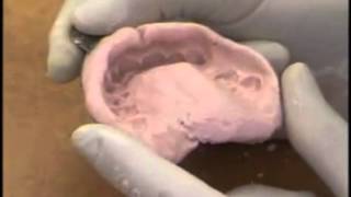 Upper Alginate Impression Evaluation [upl. by Aelc402]