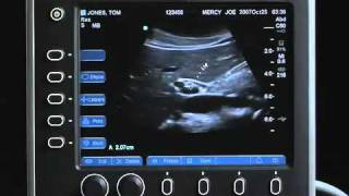 Sonosite S Series Product Training Part 3 How to Perform and Exam [upl. by Bernstein784]