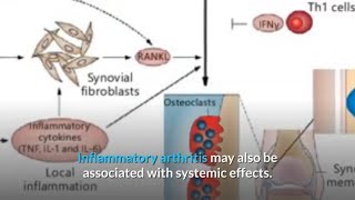 Inflammatory Polyarthritis Vs Rheumatoid Arthritis [upl. by Sirap]