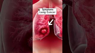 Lung Cancer Symptoms lungs lungcancersymptoms lungcancer [upl. by Revlis]