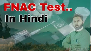 FNAC Test Results Normal Range Cost  यदि आपके शरीर में भी कोई गांठ है तो जरूर कराएं। [upl. by Cristiona]